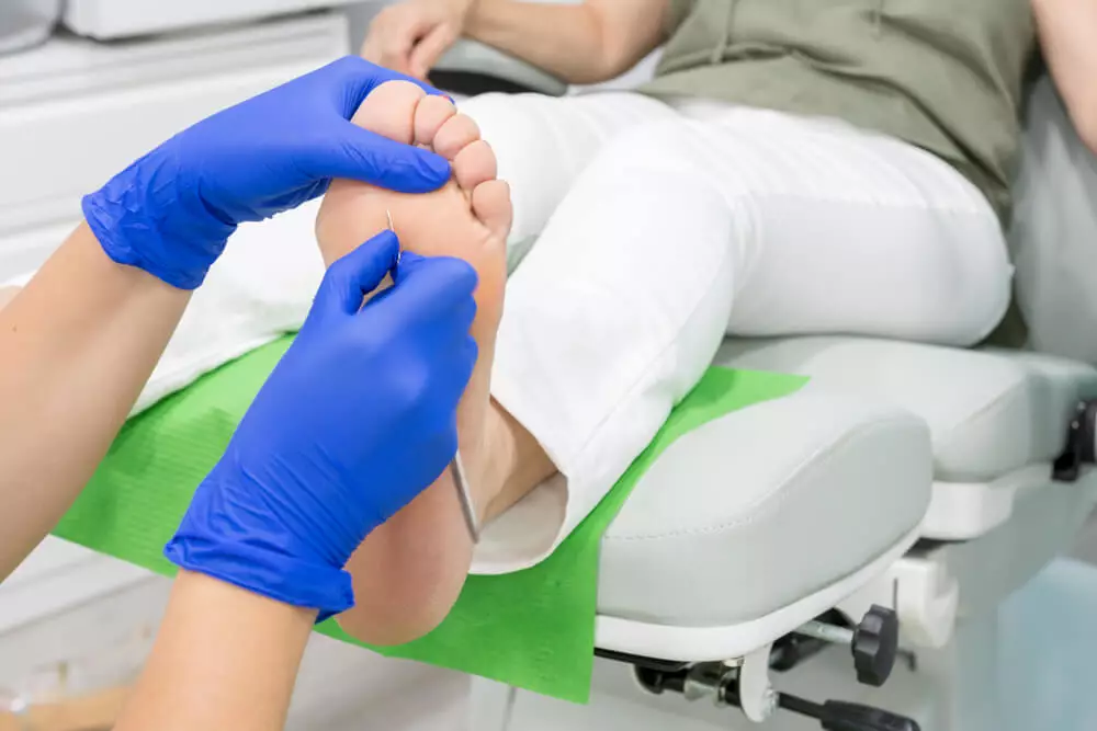 Medical pedicure picture